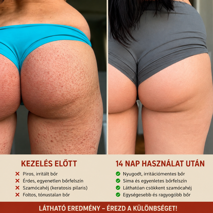 SRAWBERRY Bőrmegújító Savkomplex Eperbőrre
