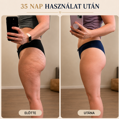 Narancsbőr Elleni Masszázsolaj